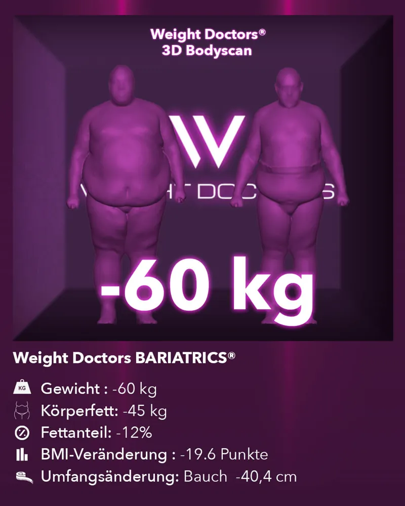 Weight Doctors® 3D-Bodyscan vorher und nachher: minus 60 kg mit Weight Doctors® BARIATRICS, Körperfett minus 45 kg