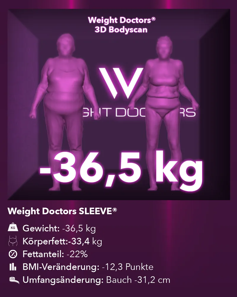 Weight Doctors® 3D-Bodyscan vorher und nachher: minus 36,5 kg mit Weight Doctors® SLEEVE, Körperfett minus 33,4 kg