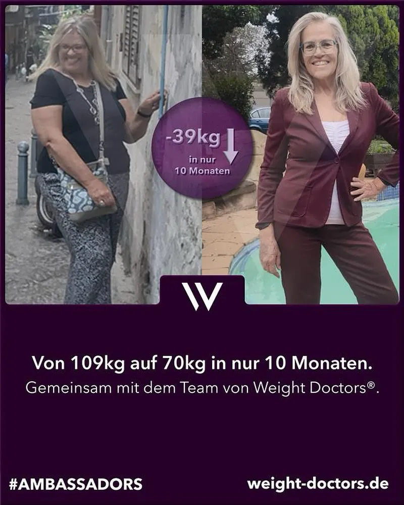 Weight Doctors® Vorher-Nachher: Patientin von 109 kg auf 70 kg in zehn Monaten, gemeinsam mit dem Team von Weight Doctors®