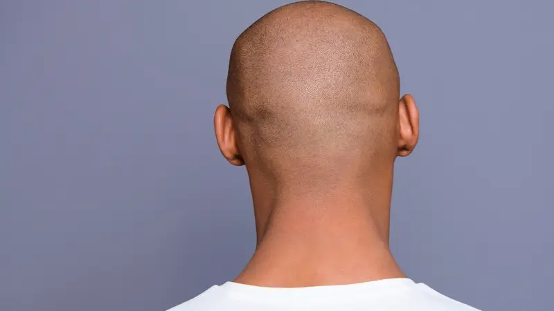 Haarausfall welcher Arzt?
